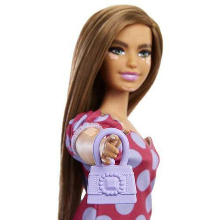 Barbie Fashionista - Select Figure(s) - Flip Side CollectiblesFashion DollToyShnip171 Vitiligo with Polka Dot Dress