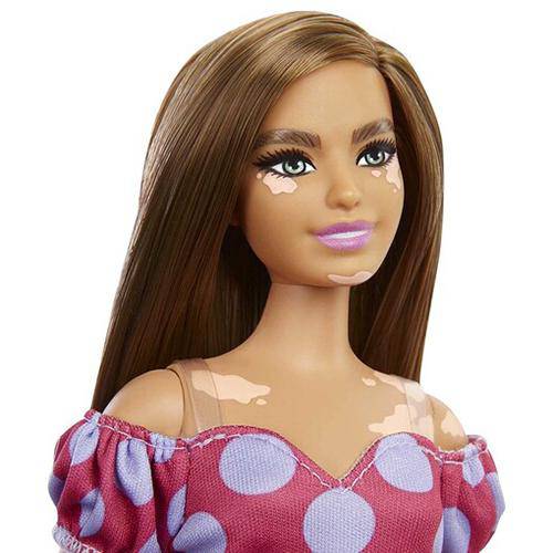 Barbie Fashionista - Select Figure(s) - Flip Side CollectiblesFashion DollToyShnip171 Vitiligo with Polka Dot Dress